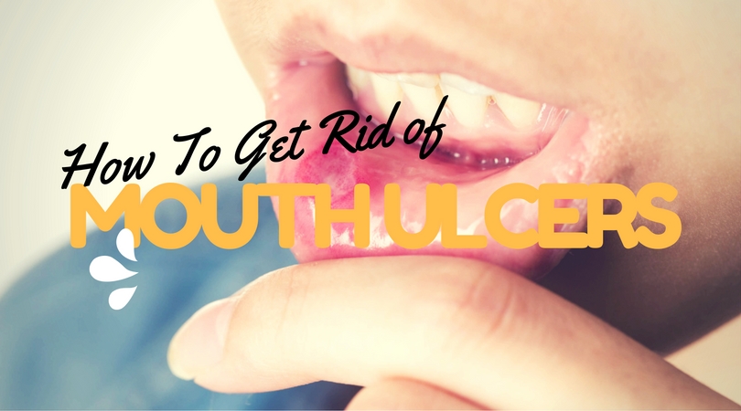 How to get rid of mouth ulcers