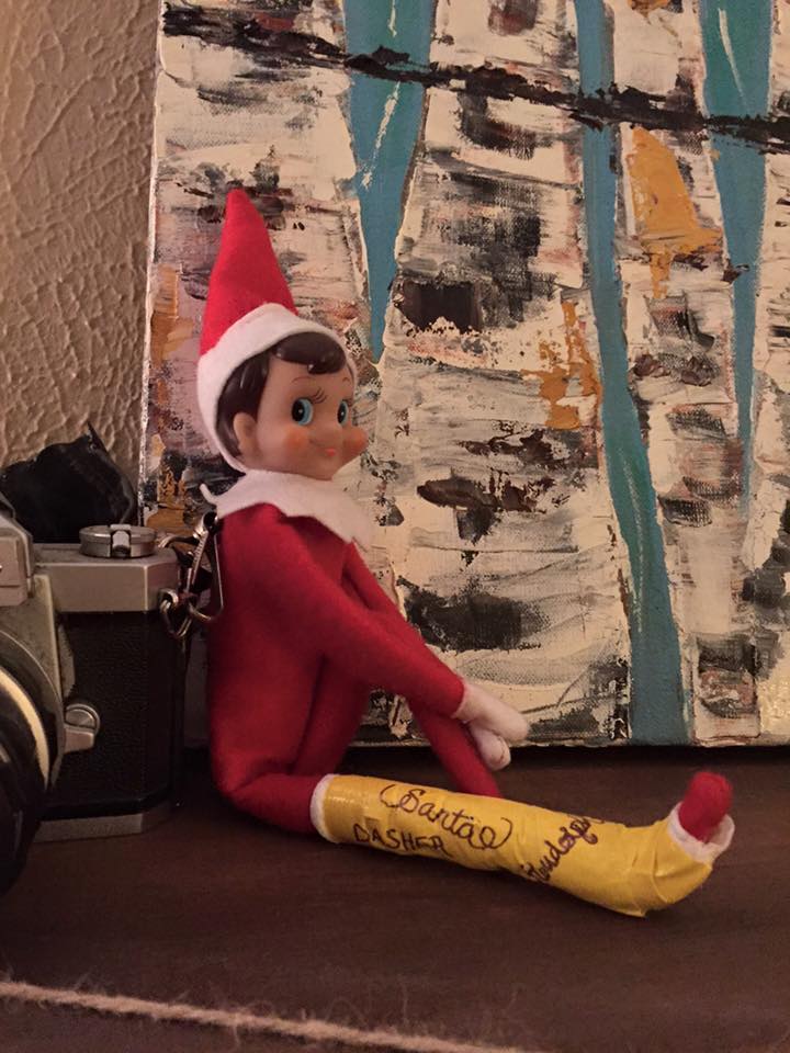 Broken Leg Elf | Fun & Simple Elf on Shelf Ideas For This Christmas