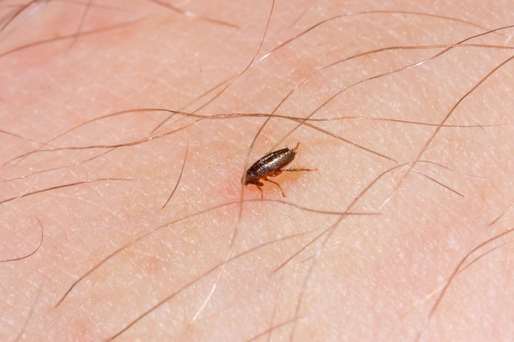 flea bites on a human