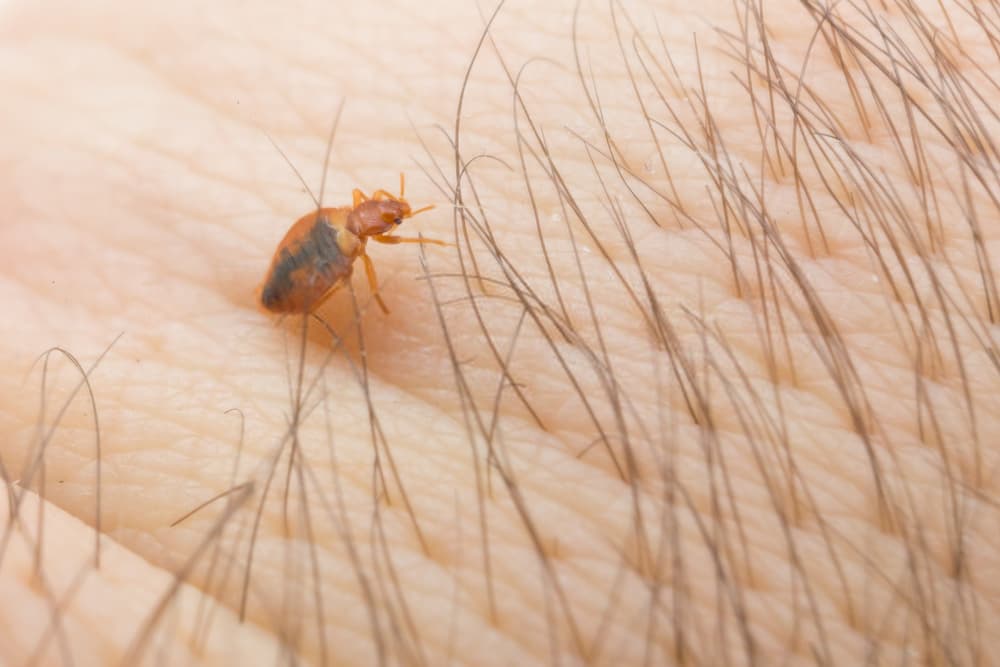 bed bug on body