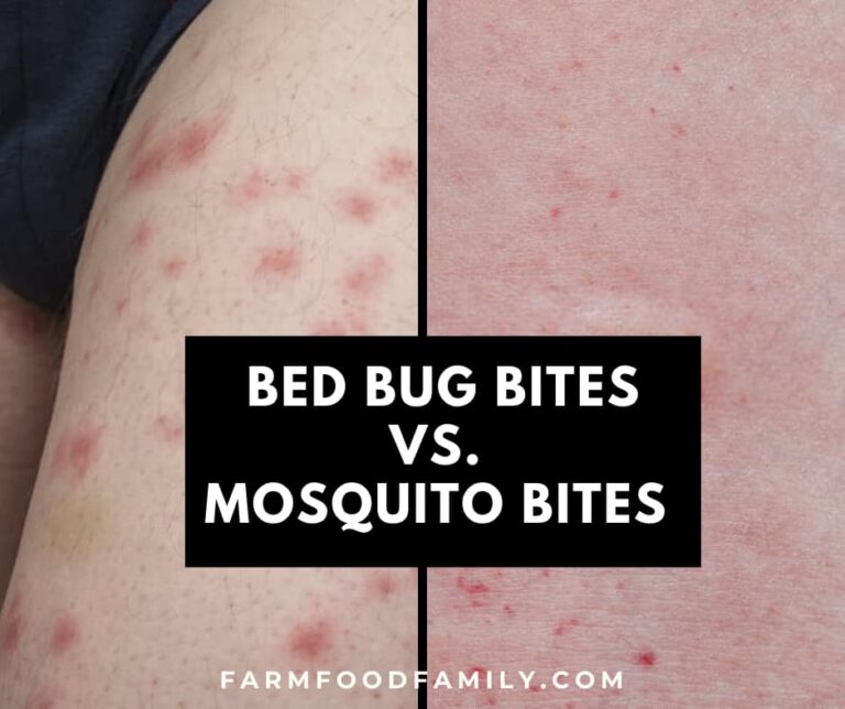 Bed Bug Bites vs. Mosquito Bites: Similarities and Differences